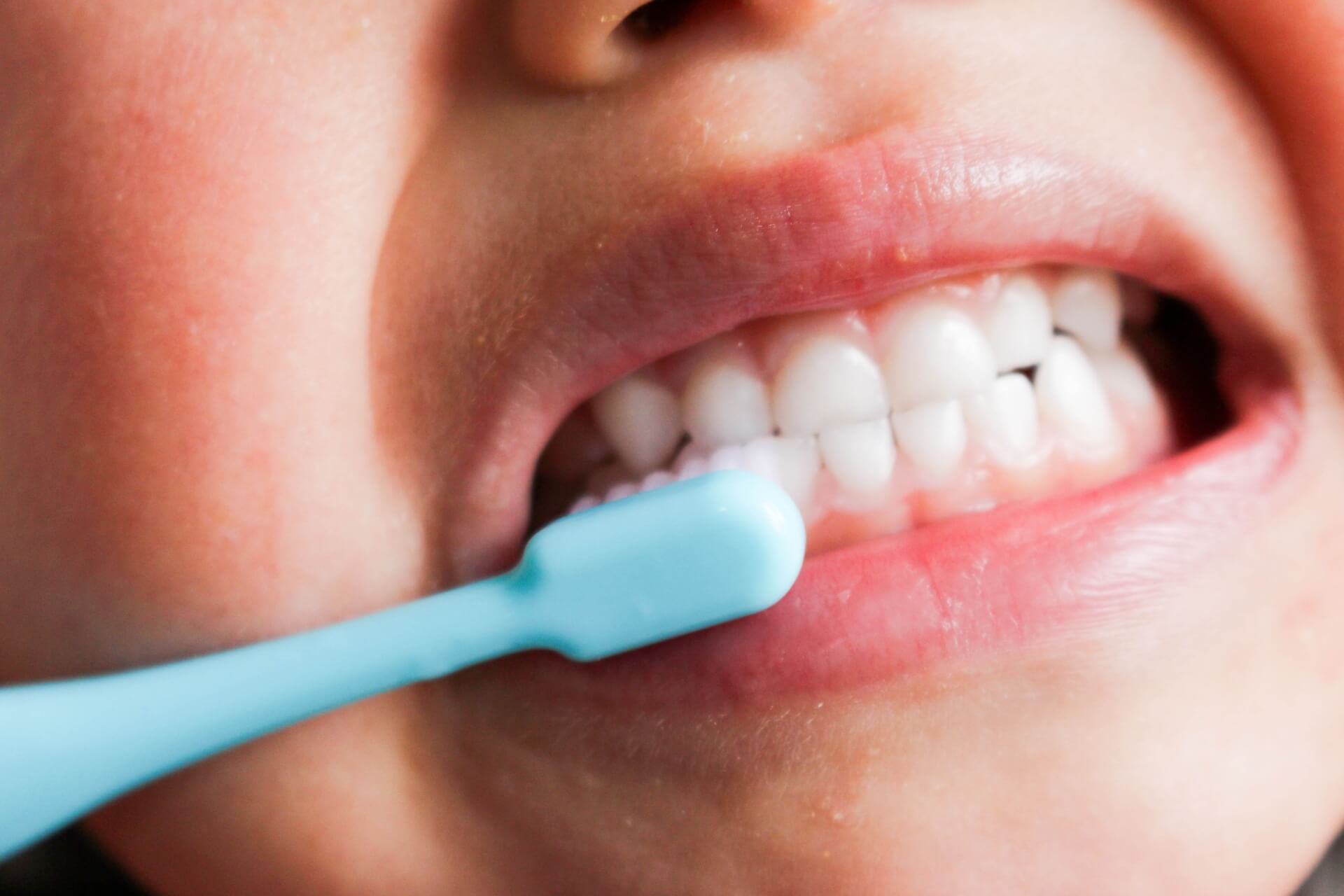 子供の歯・乳歯は虫歯予防が超重要